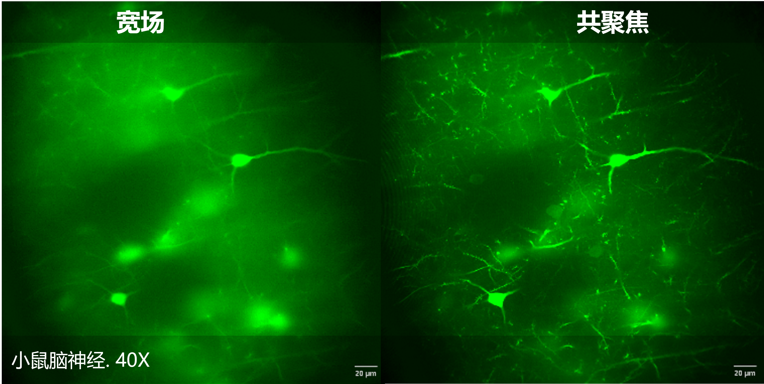 Widefield vs Confocal Comparison (Mouse Brain Neurons 40X)