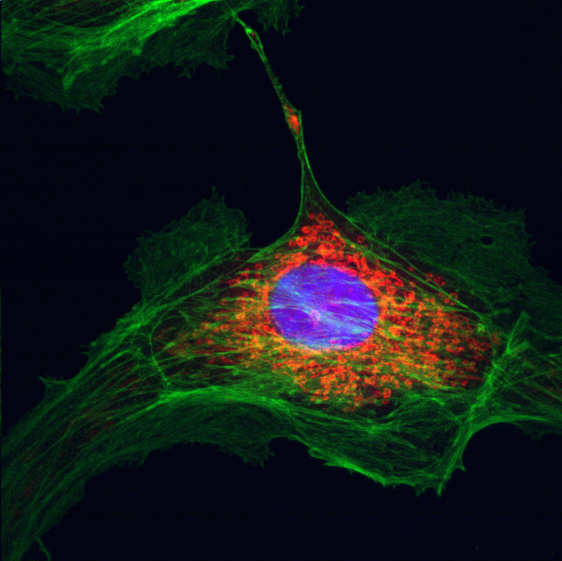 BPAE cells#1-60X-Composite
