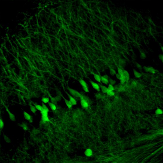 Mouse nerve single-point scanning image