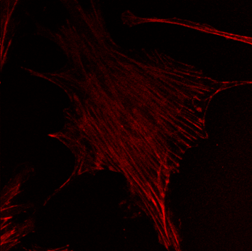 BPAE cells#2-60X-561nm