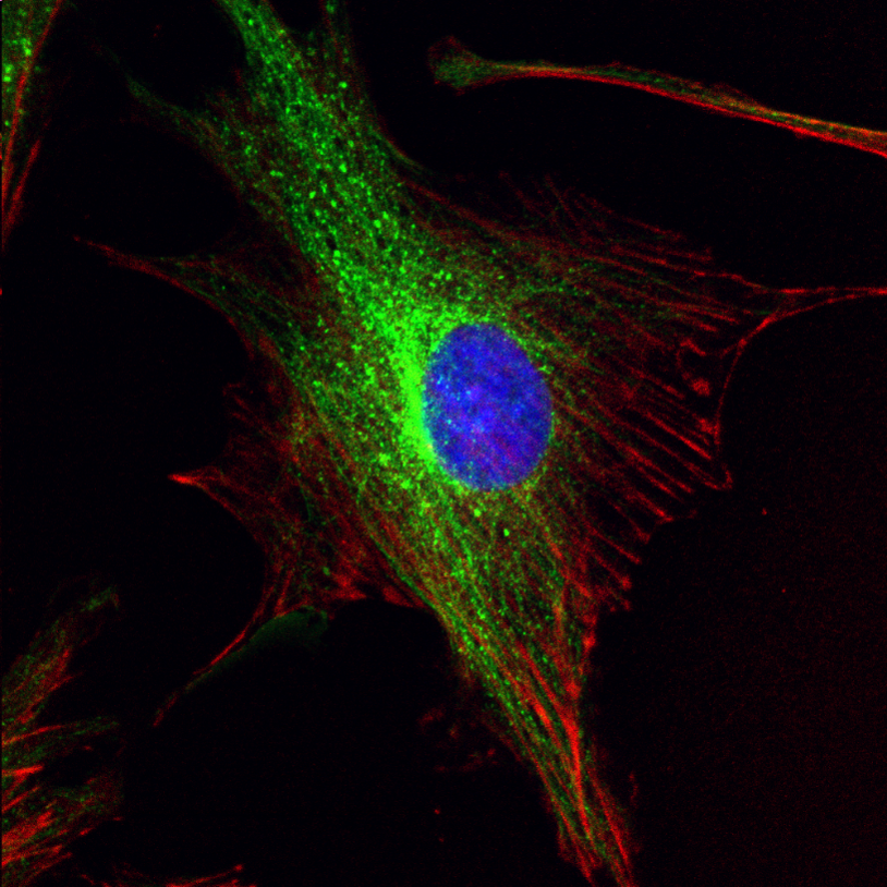 BPAE cells#2-60X-Composite